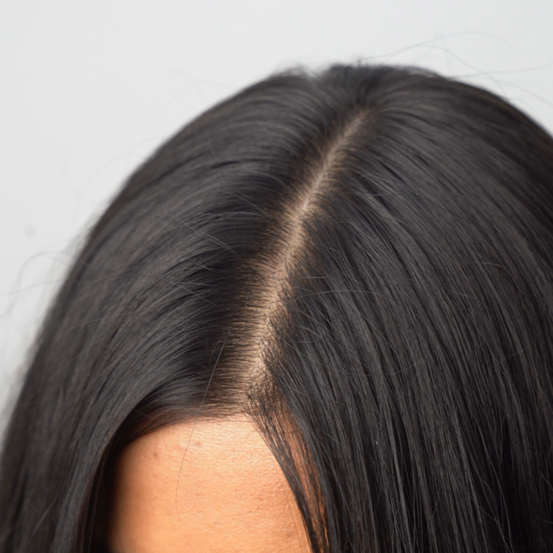 5 Natural Herbs In Your Kitchen That Actually Control Dandruff