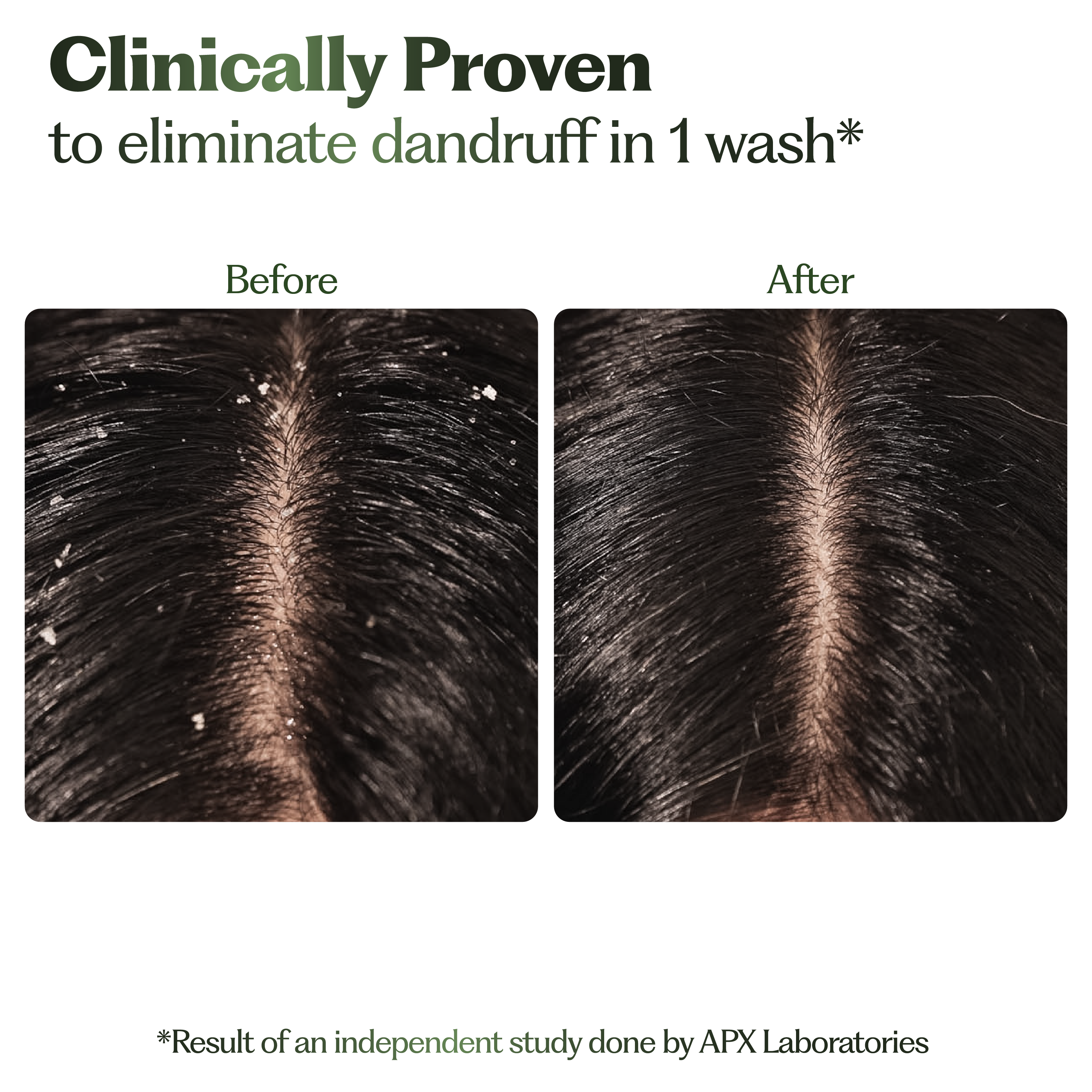 Anti-Dandruff Combo
