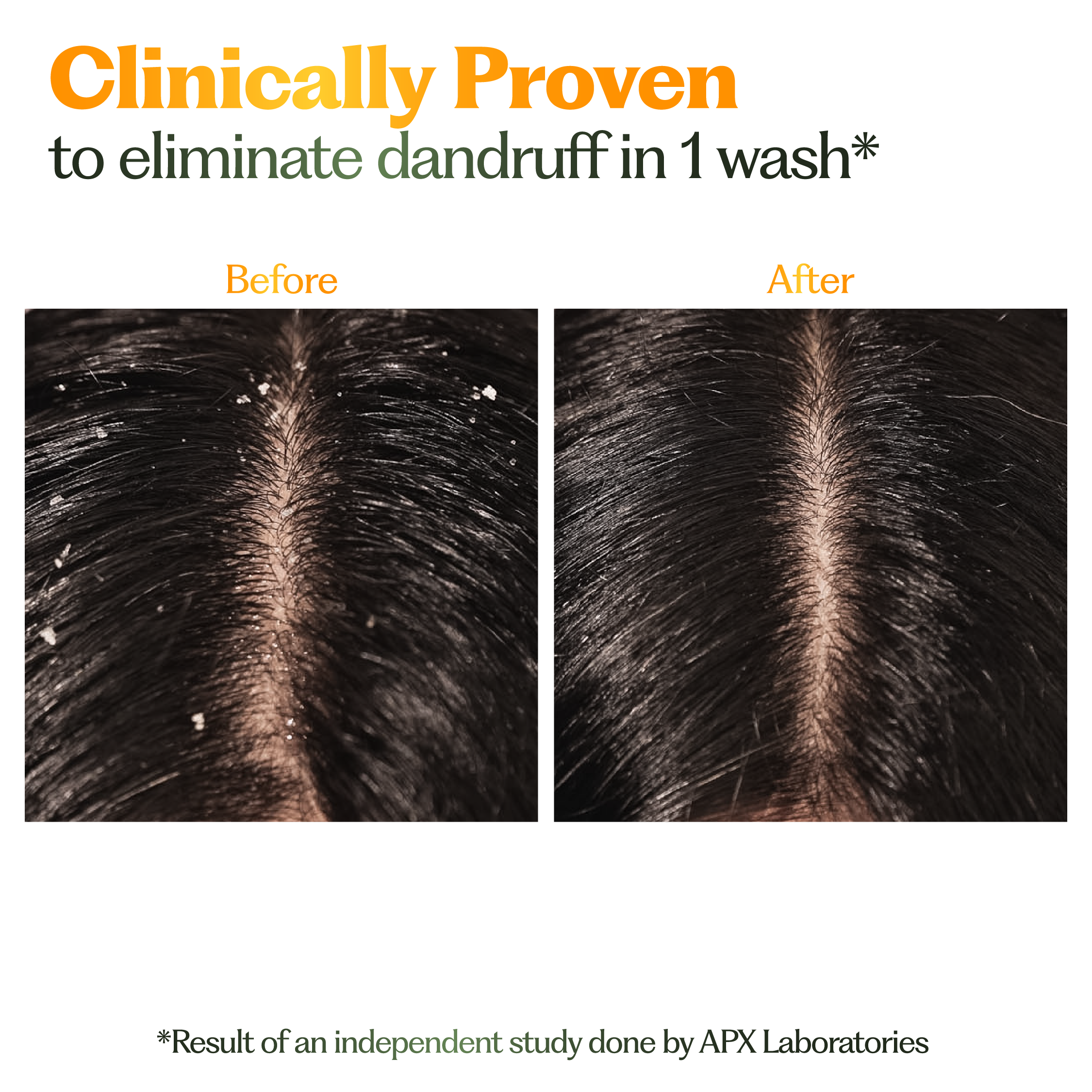 Anti-Dandruff Hair Mask