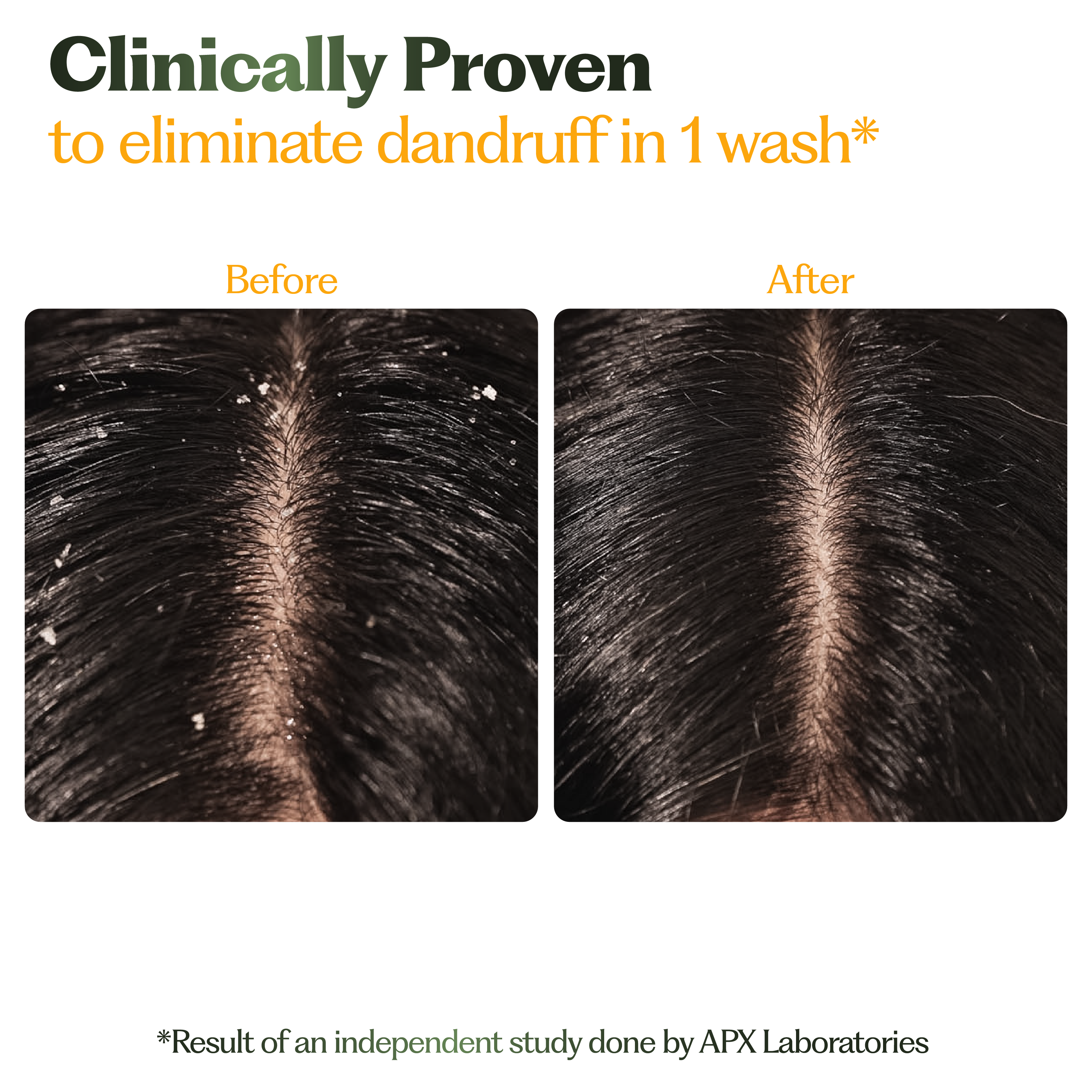 Anti-Dandruff Hair Mask