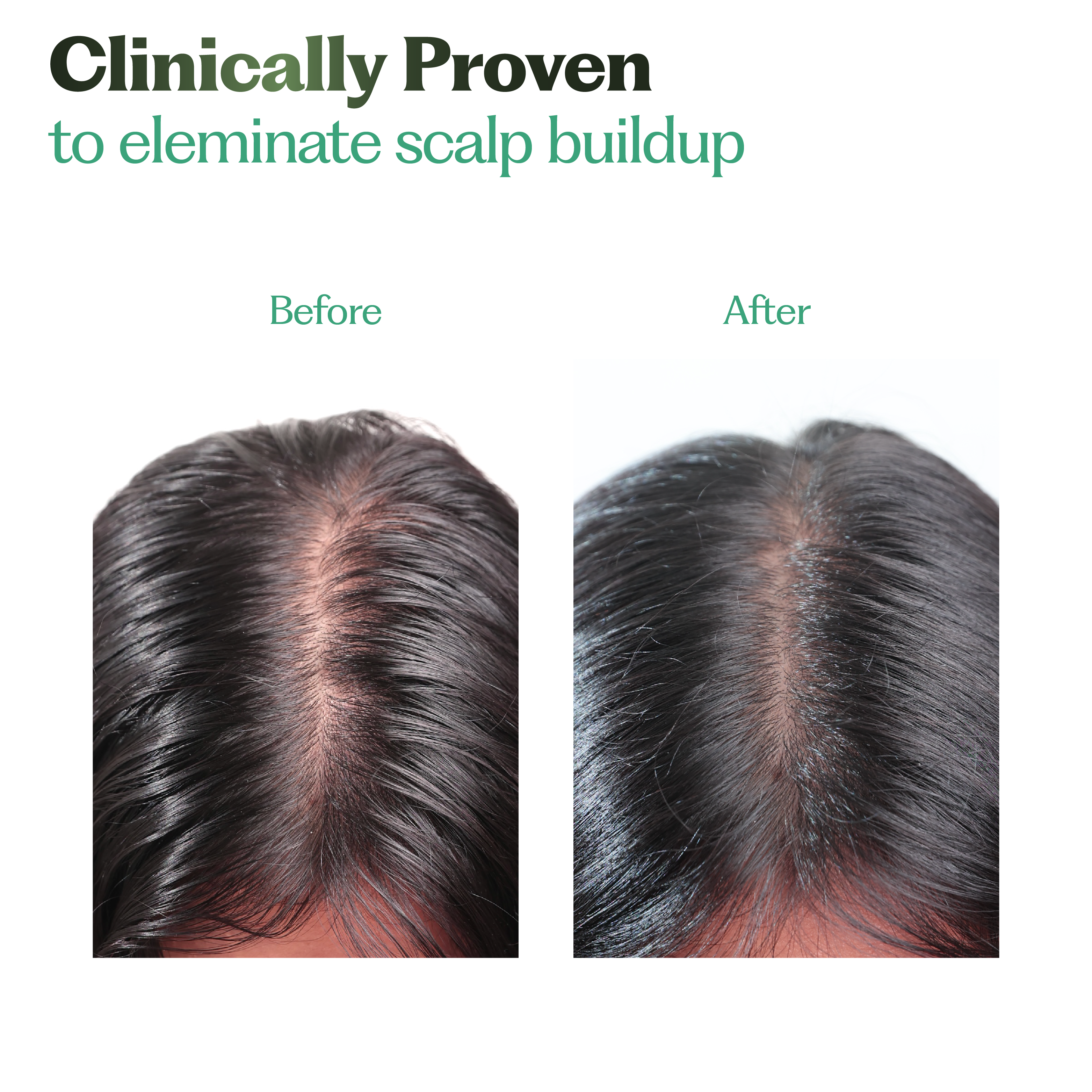 Deep-Clean Scalp Mask