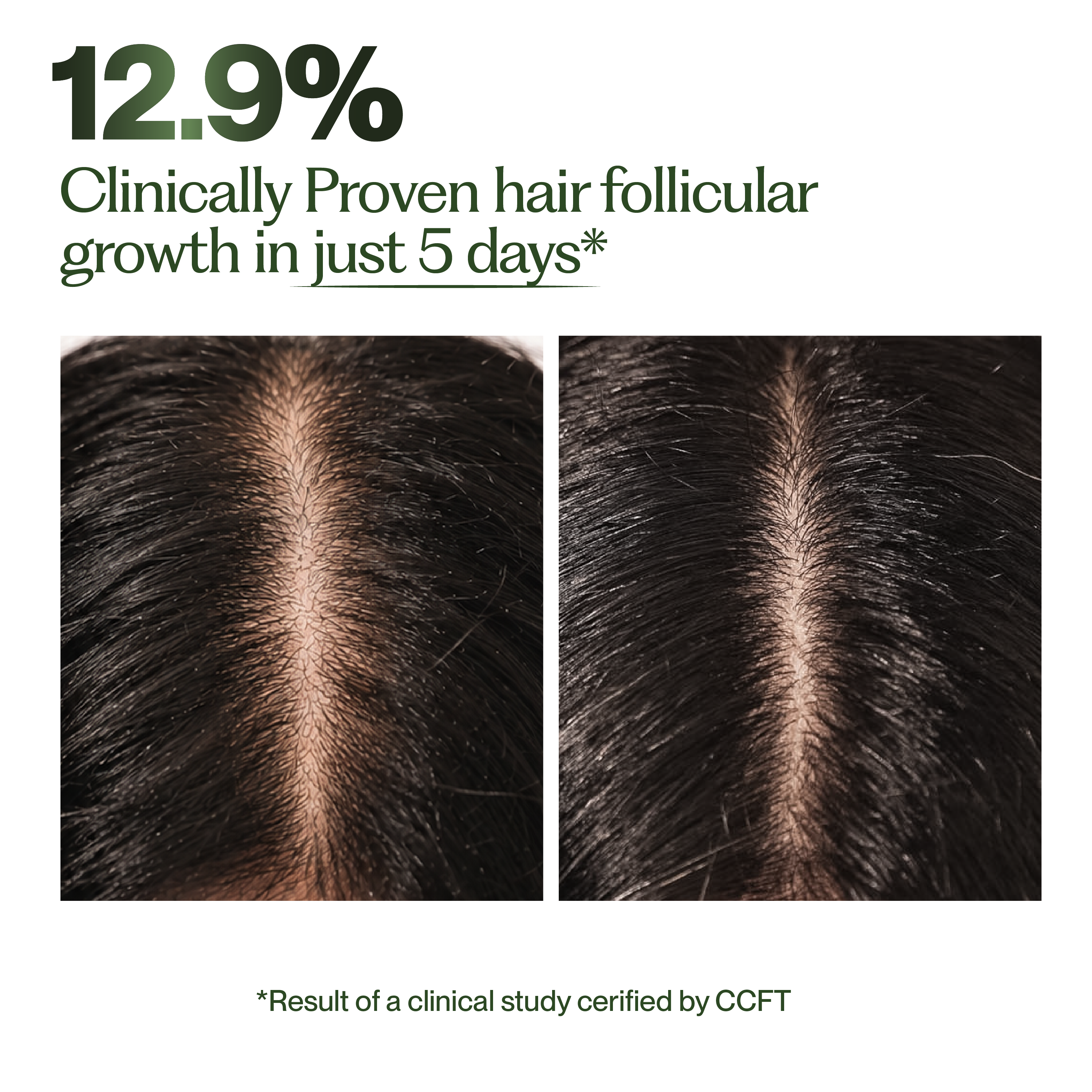 Hair Growth Routine