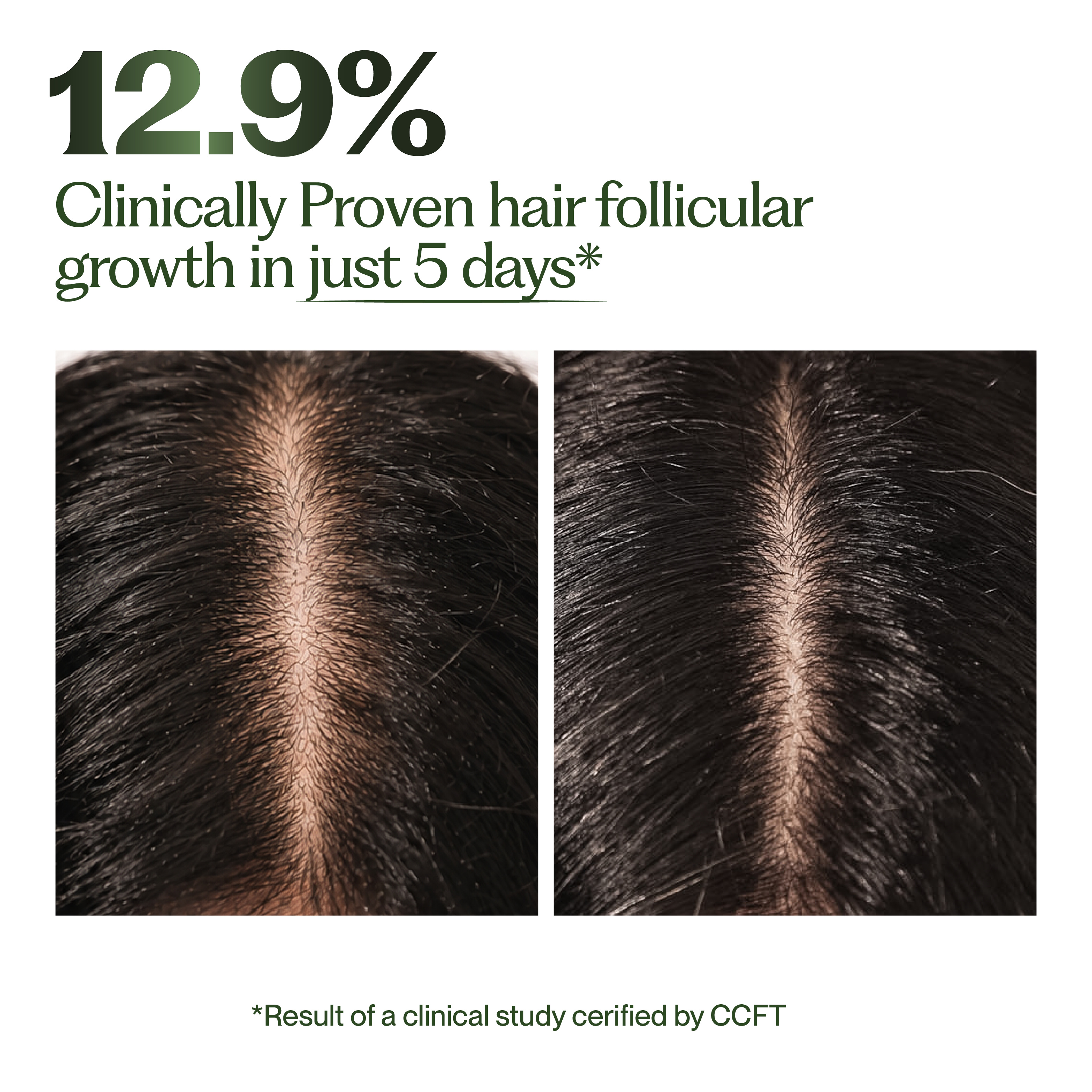 Hair Growth Oil